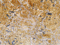 Fusion, 225x150, Acryl, Iran